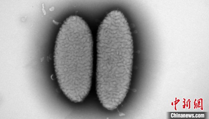 广东丹霞山发现微生物新属新种——丹霞红岩杆菌【秘鲁新世界日报】